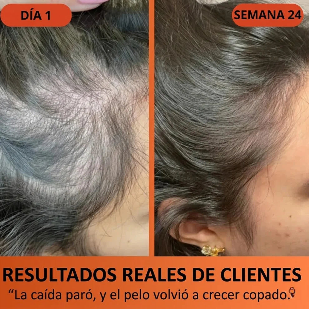 Nutraessence – Cápsulas de Crecimiento Capilar: Más Volumen y Menos Caída en 90 Días